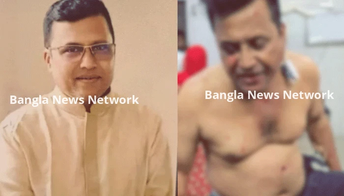 কুষ্টিয়ায় আওয়ামী লীগ নেতা গুলিবিদ্ধ