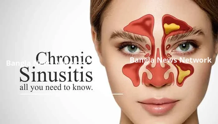 সাইনাস থেকে মুক্তির ঘরোয়া উপায়