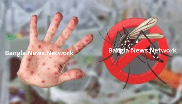 ডেঙ্গু-হাম পরিস্থিতি উদ্বেগজনক